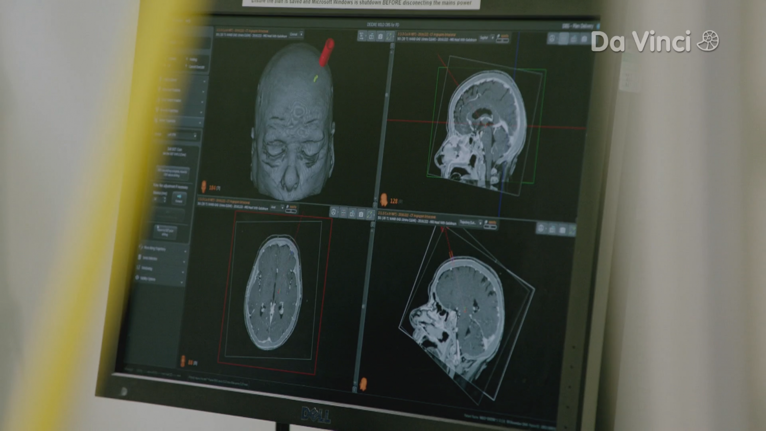 Кадр 4 з Чи можна полагодити такий мозок, як у мене?