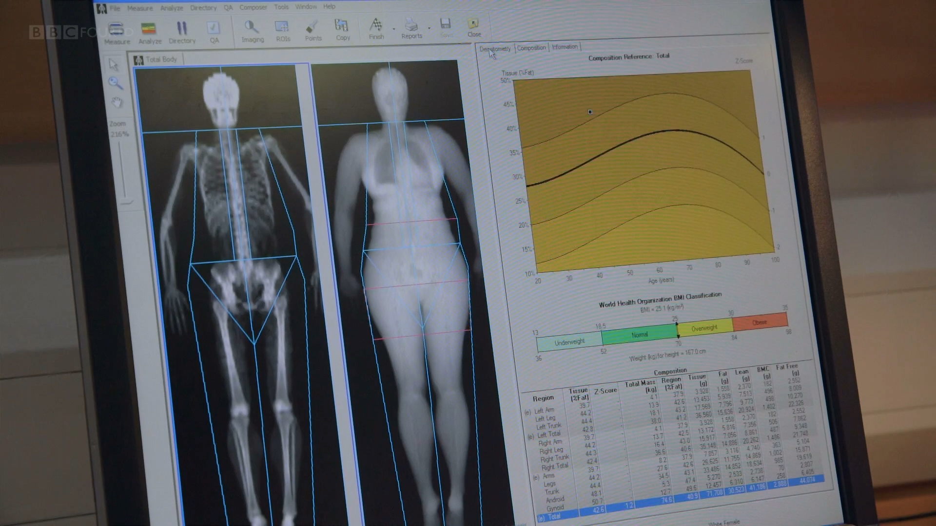 Кадр 4 з Фантастичний світ гормонів з доктором Джоном Уоссом