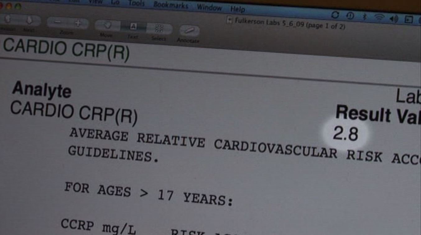 Кадр 1 з Виделки замість ножів